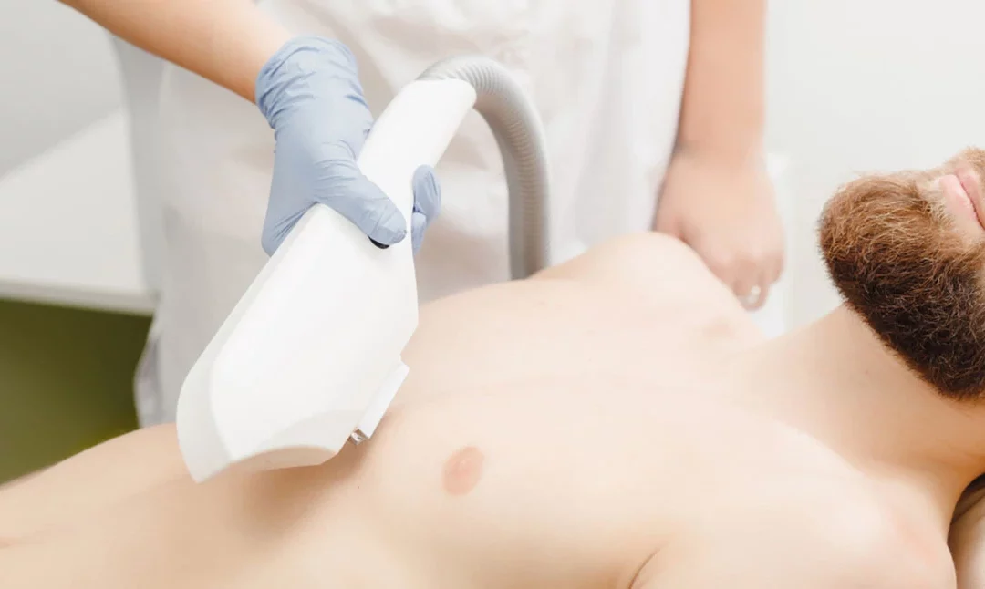 Préparez votre traitement d’épilation au laser à Villefranche et Lyon