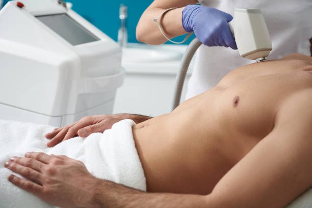 RÉGIONS POPULAIRES POUR L’ÉPILATION LASER DES HOMMES