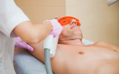 Épilation au laser 101 pour les hommes