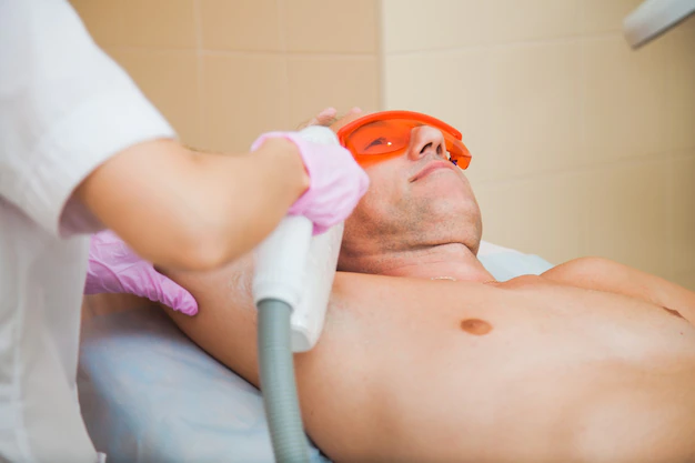 Épilation au laser 101 pour les hommes