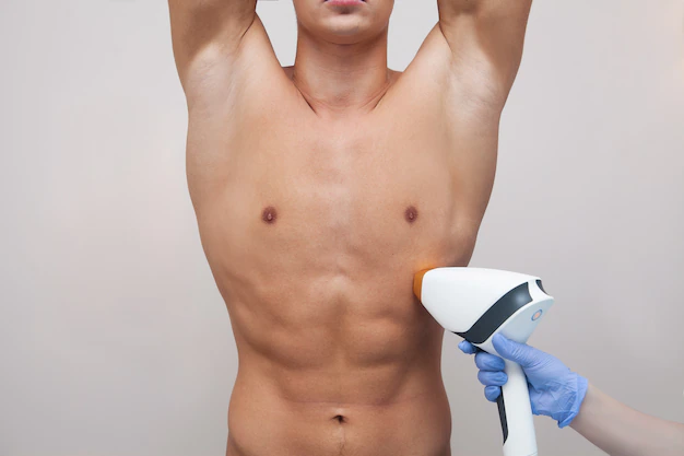 L’épilation au laser est-elle efficace pour les hommes ? Les 4 principales raisons pour lesquelles les hommes devraient envisager ce traitement