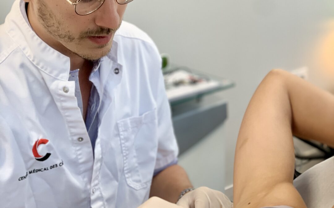 L’Innovation Révolutionnaire pour Contrôler la Transpiration Excessive