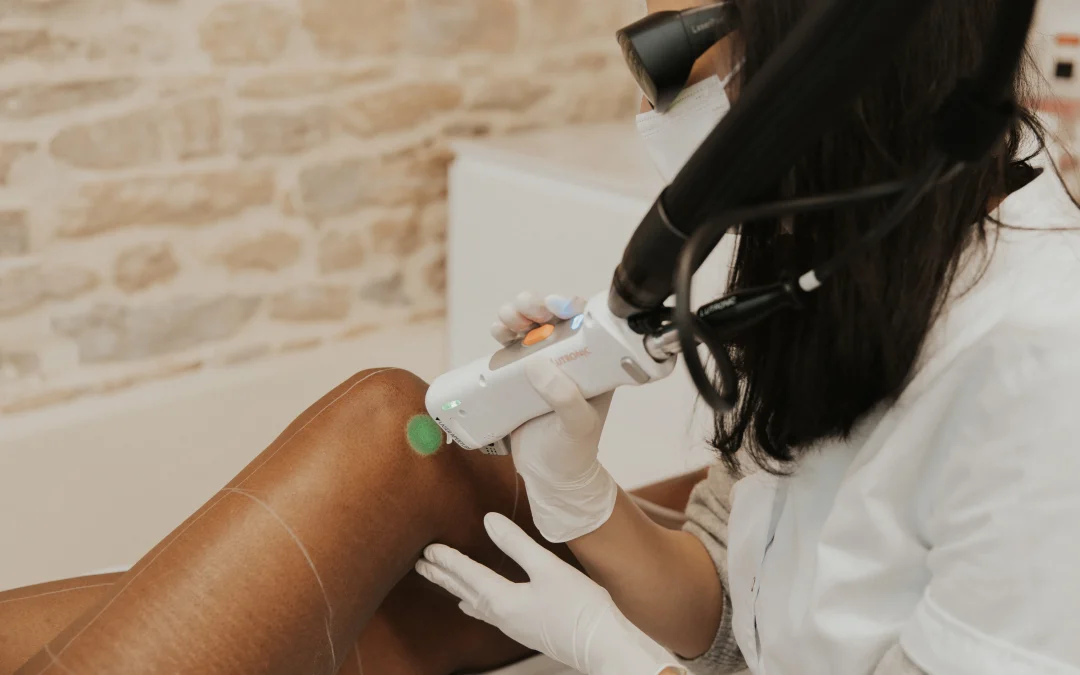 Épilation laser ou lumière pulsée ?