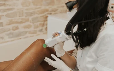 Épilation laser ou lumière pulsée ?