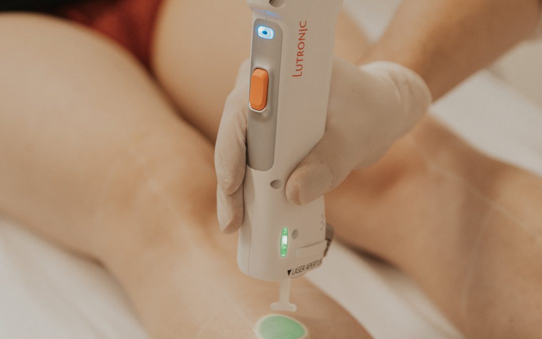 Le duvet peut-il être traité par l’épilation laser ?