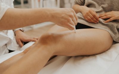 La meilleure période de l’année pour commencer l’épilation laser