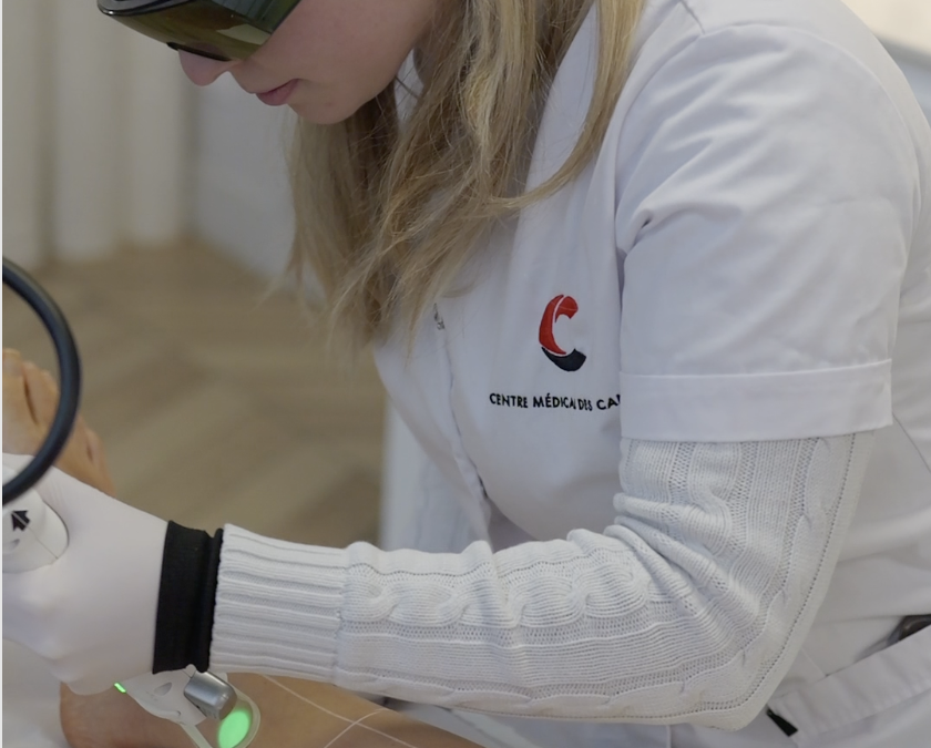 Épilation laser chez les adolescents : est-ce recommandé ?