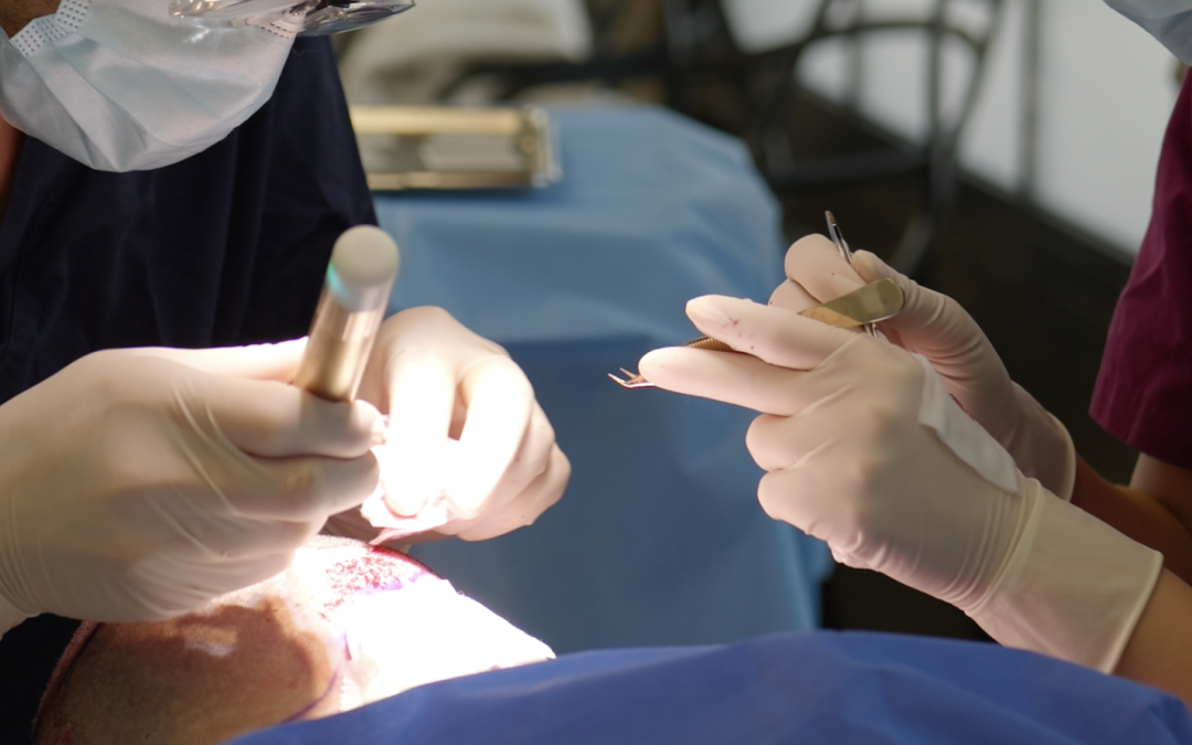 Le coût d’une greffe capillaire