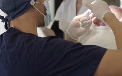 Les greffes capillaires chez les jeunes