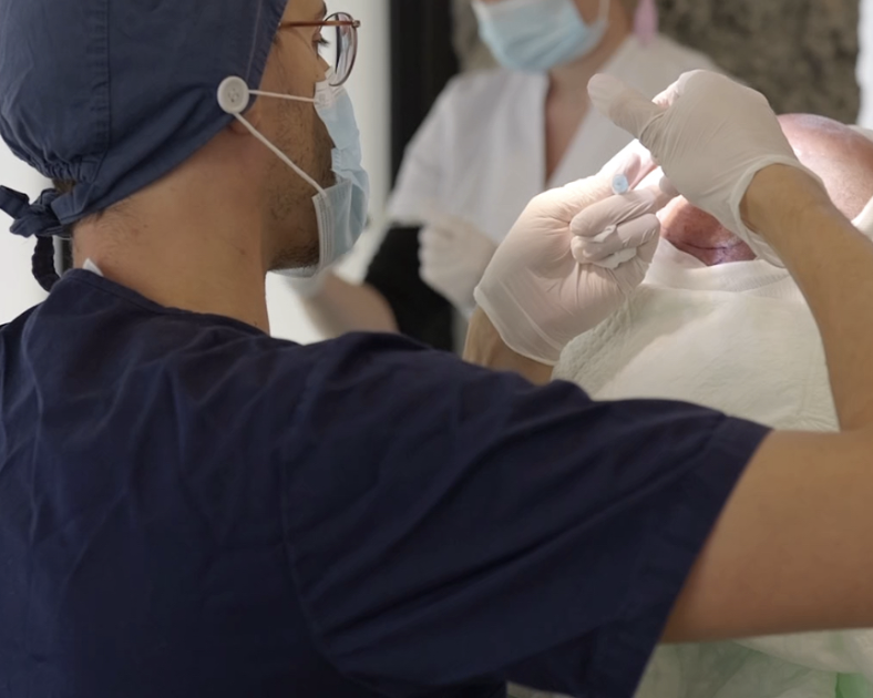 Les greffes capillaires chez les jeunes