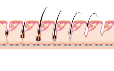 Quel délai entre deux séances d’épilation laser ?