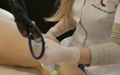 Comment savoir si ma séance de laser est efficace ?