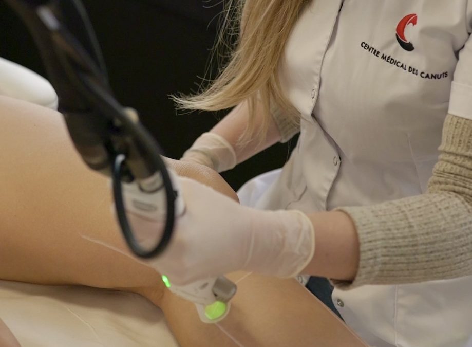 Comment savoir si ma séance de laser est efficace ?