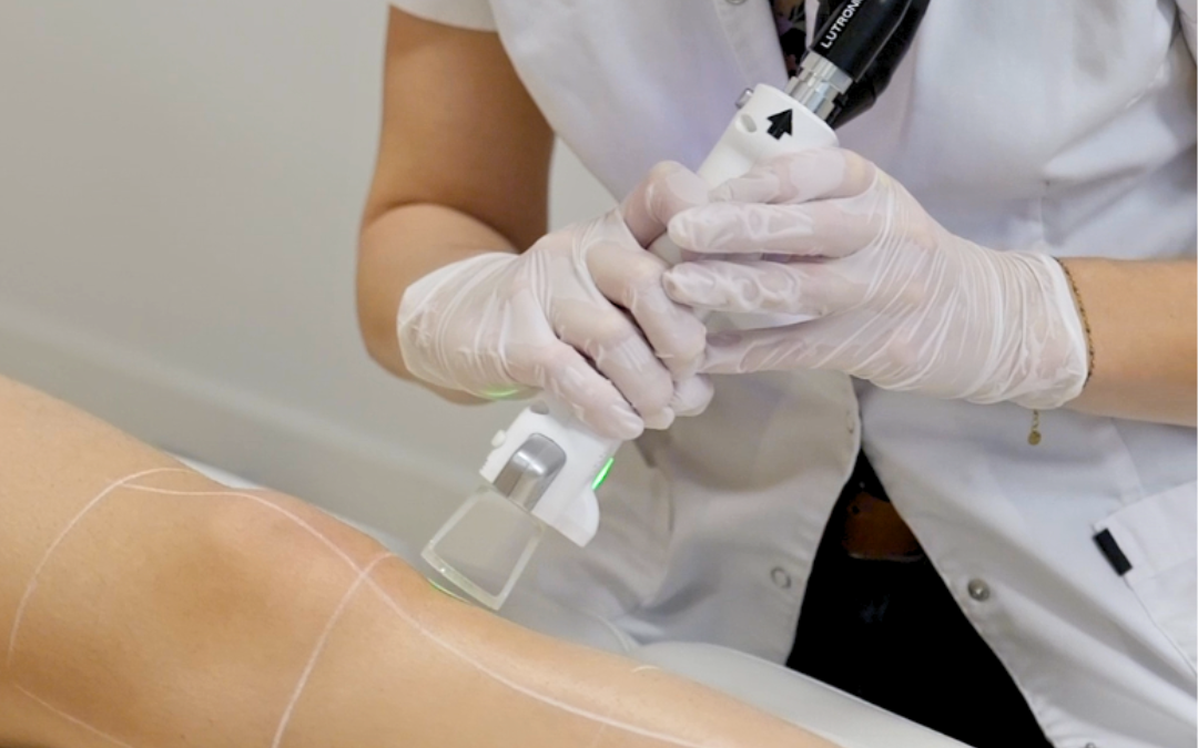 10 conseils pour bien se préparer à une séance d’épilation laser