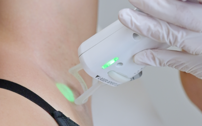 L’épilation au laser est-elle un risque de cancer ?