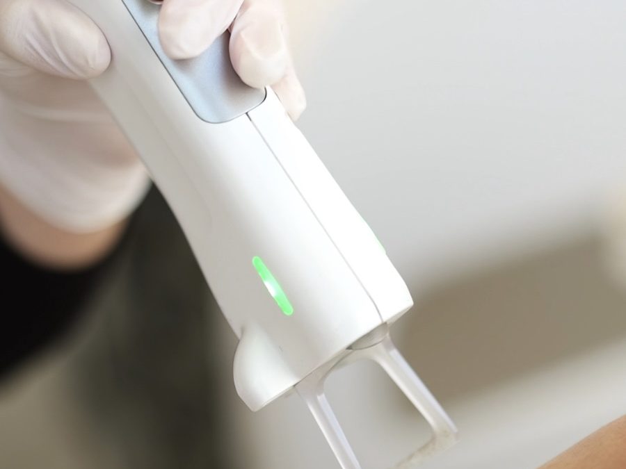 Est-ce que le laser fait plus mal que la lumière pulsée ?