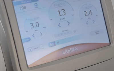 Pourquoi mes poils ne partent pas au laser ?