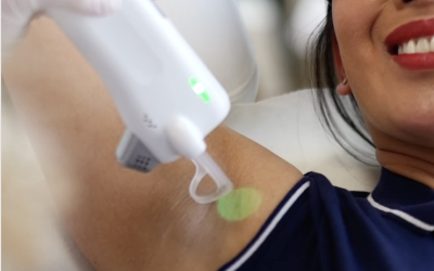 L’épilation laser est-elle rentable ?