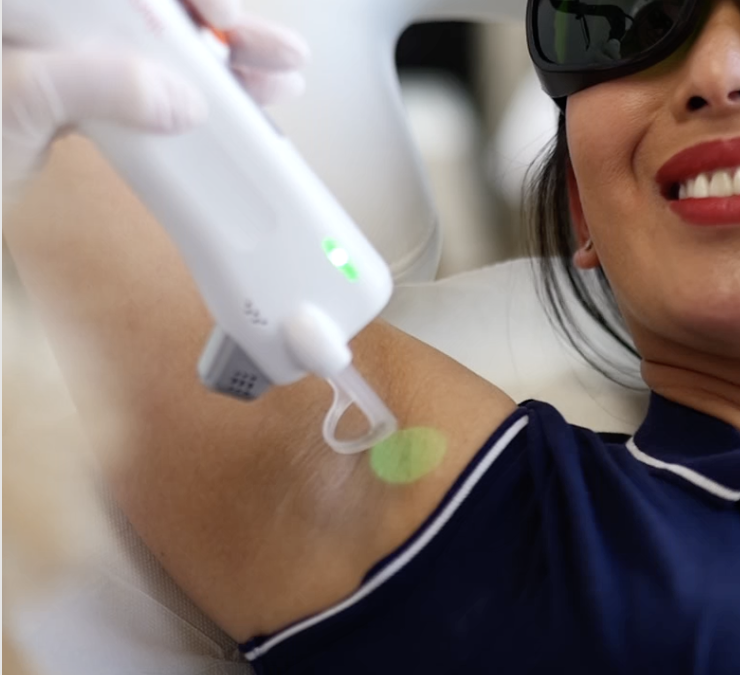 L’épilation laser est-elle rentable ?