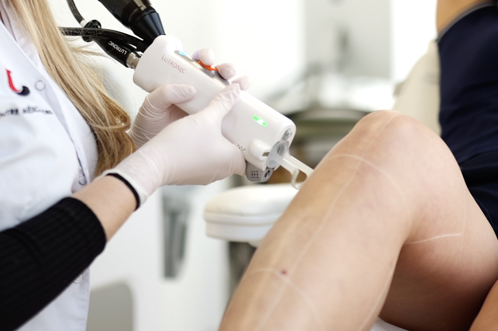 L’épilation laser est-elle dangereuse pour la zone intime ?