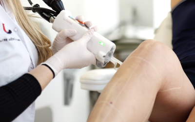 L’épilation laser est-elle dangereuse pour la zone intime ?