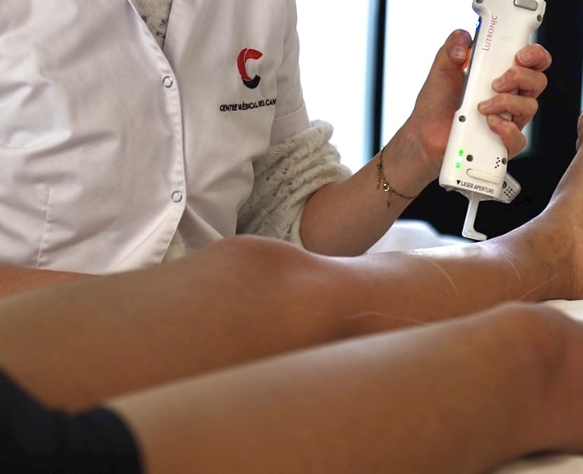 Pourquoi choisir l’épilation laser ?