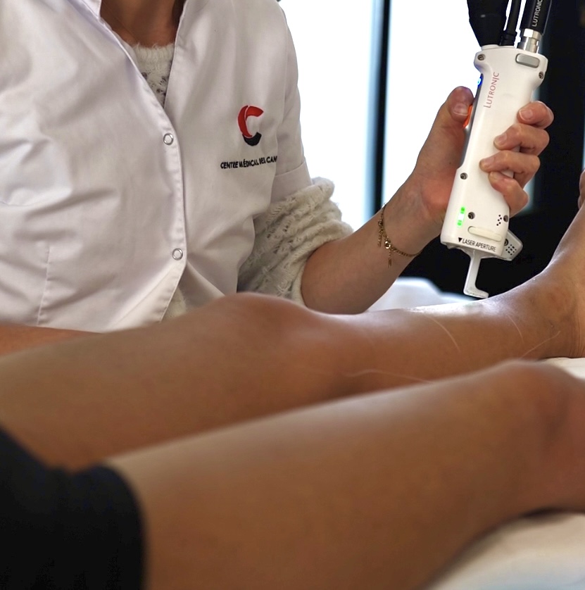 Épilation laser définitive à lyon