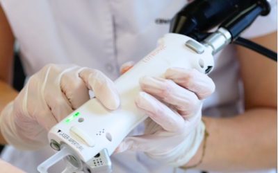 Épilation laser et poils blancs