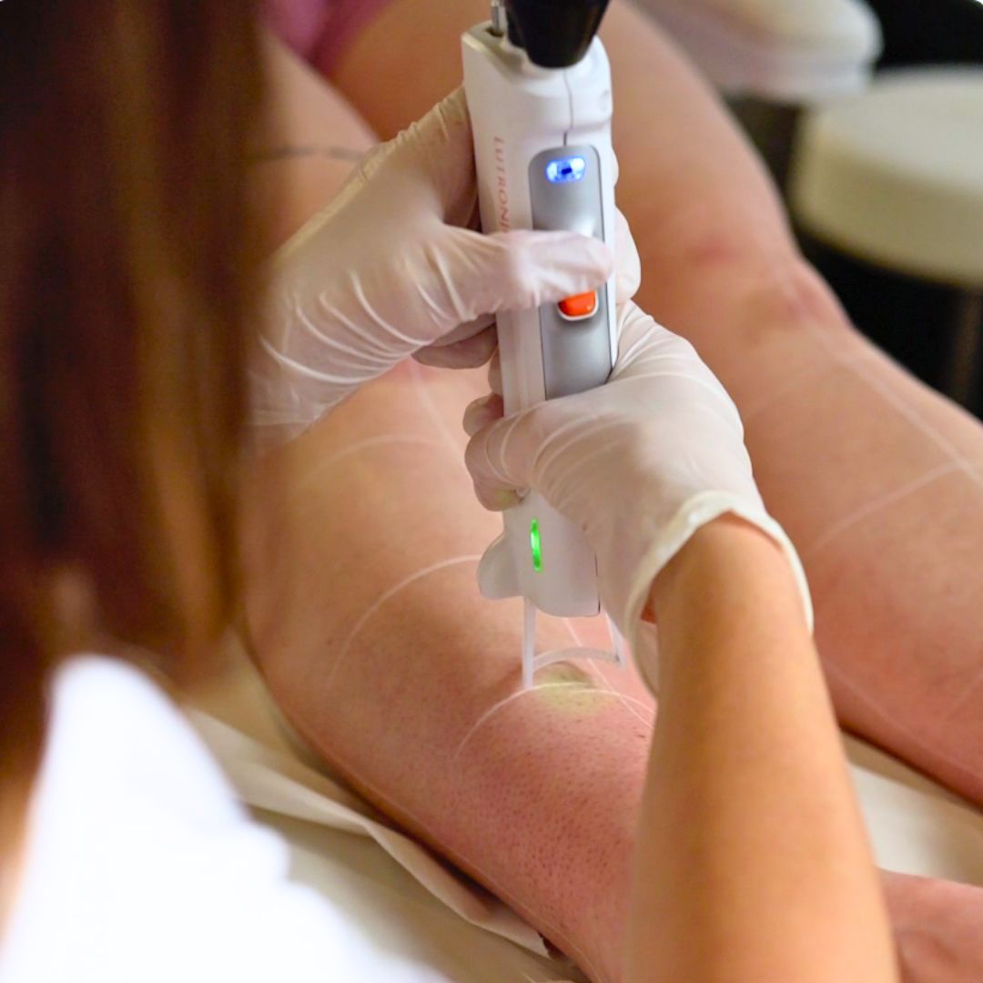 Pourquoi certaines zones repoussent plus vite ?