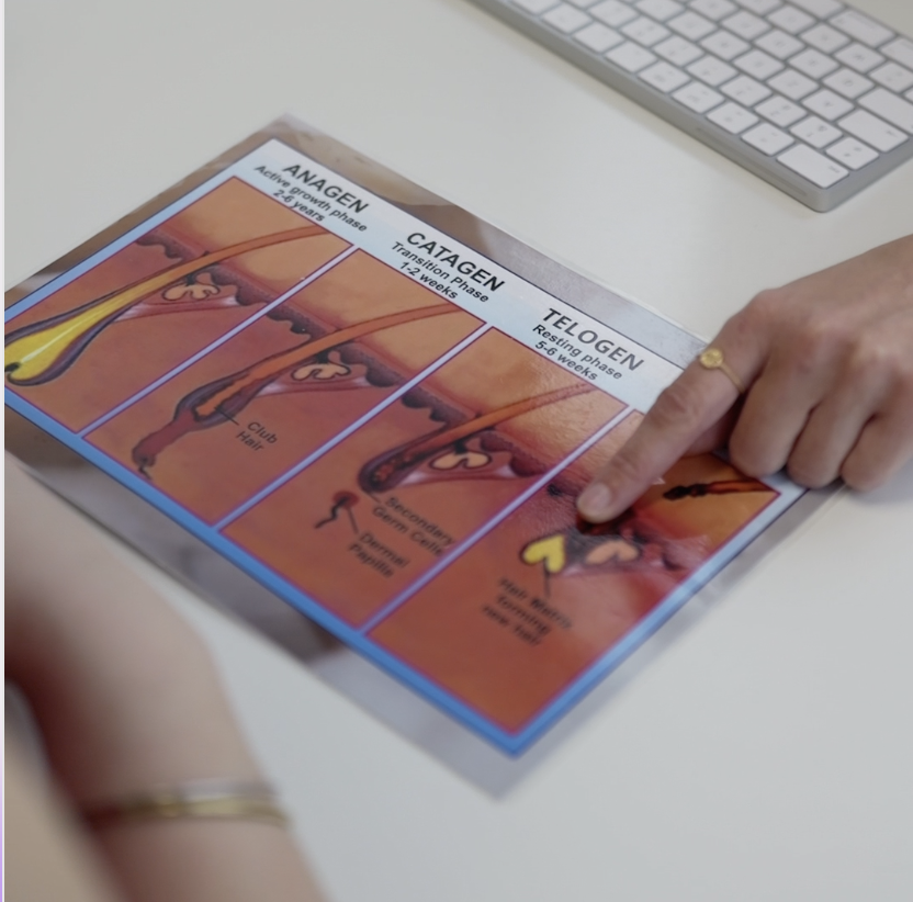 cycle pilaire épilation laser