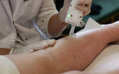 Comment fonctionne le laser sur le follicule pileux ?