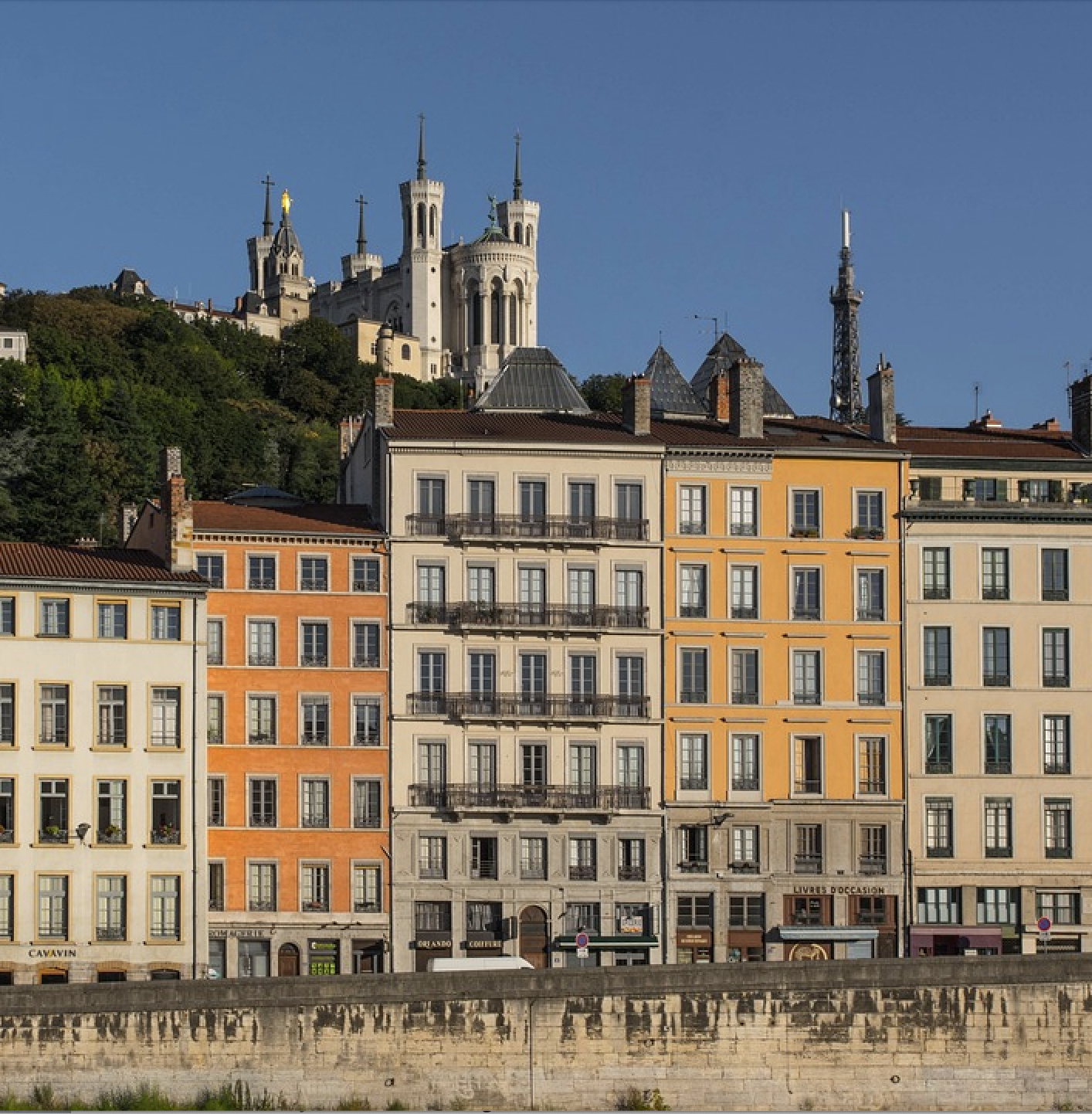 épilation laser à Lyon