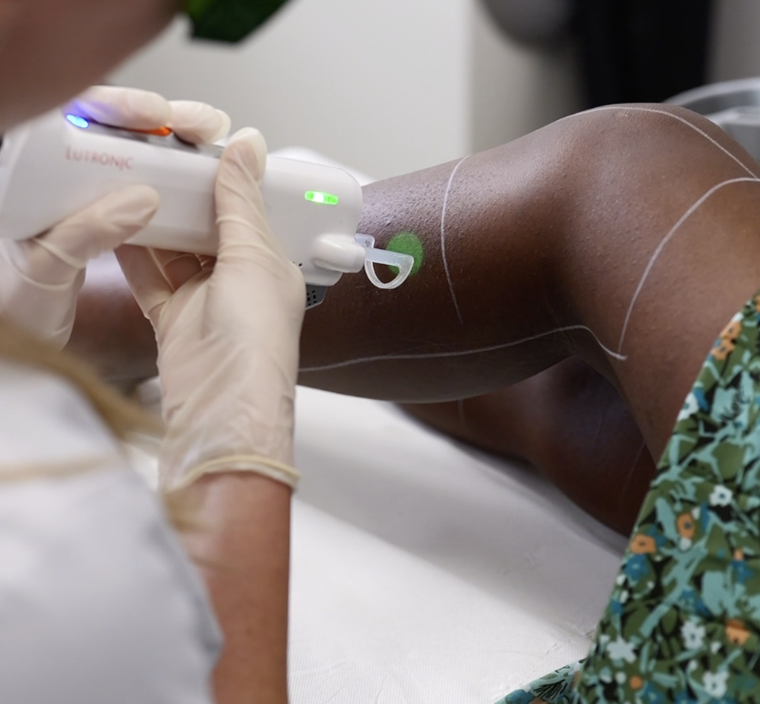 Comment fonctionne le laser sur le follicule pileux ?