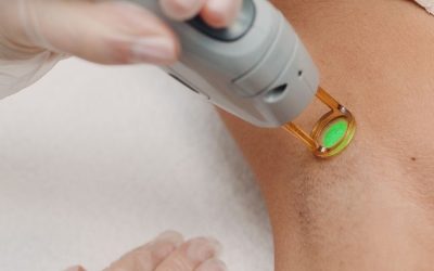 Épilation laser et rasage : pourquoi faut-il se raser avant une séance ?