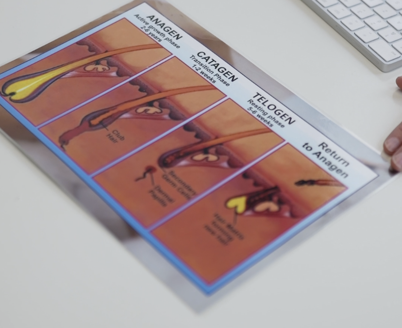 Glossaire de l’épilation laser