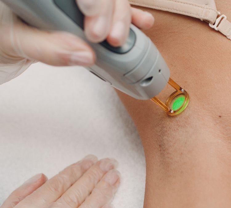 Épilation laser et rasage : pourquoi faut-il se raser avant une séance ?