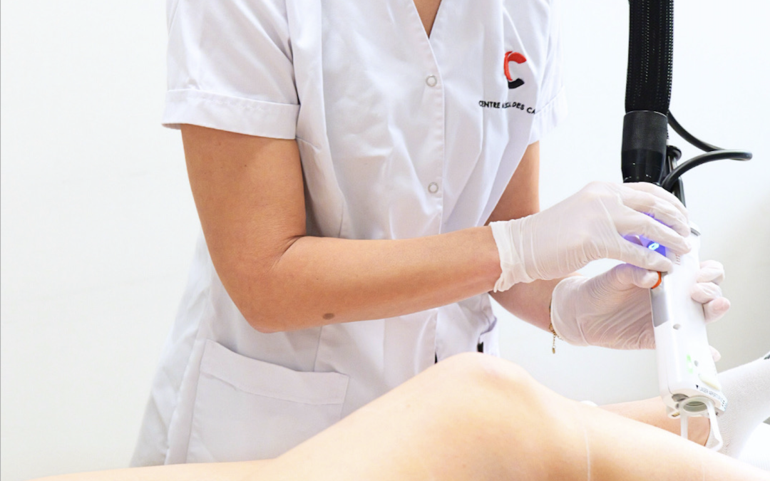 L’épilation définitive, est-ce vraiment définitif ?